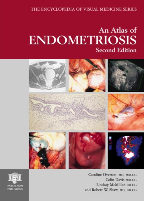 Atlas Of Endometriosis Atlas Of Endometriosis