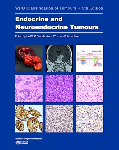 Endocrine and Neuroendocrine Tumours , 5th