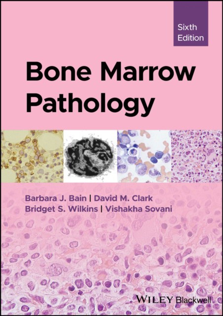 Bone marrow pathology Bone marrow pathology