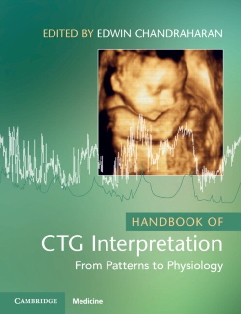 Handbook of ctg interpretation