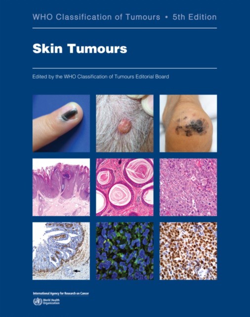 WHO Classification of Skin Tumours 5th edition