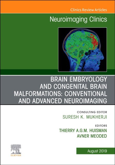 Brain Embryology And The Cause Of Congenital Malformations, An Issue Of Neuroimaging Clinics Of North America,29-3