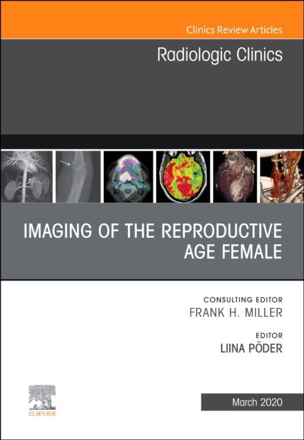 Imaging Of The Reproductive Age Female,An Issue Of Radiologic Clinicsof North America,58-2