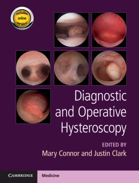 Diagnostic and Operative Hysteroscopy