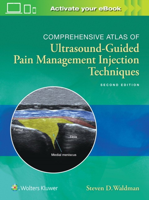 Comprehensive atlas of ultrasound-guided pain management injection techniques