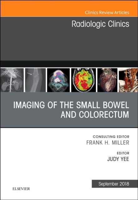 Imaging of the Small Bowel and Colorectum, An Issue of Radiologic Clinics of North America,56-5