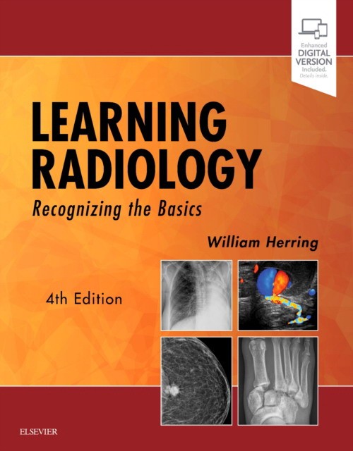 Learning Radiology: Recognizing the Basics . Elsevier Science. - 4 ed.