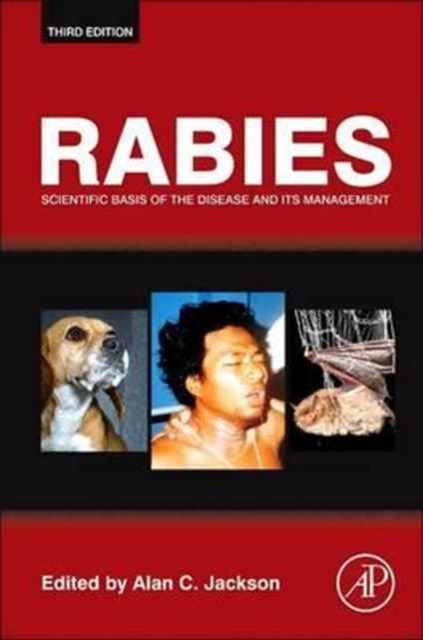 Rabies