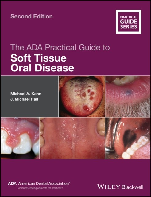 The ADA Practical Guide to Soft Tissue Oral Disease