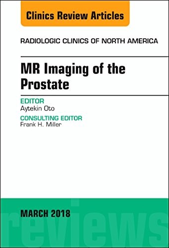 MR Imaging of the Prostate, An Issue of Radiologic Clinics of North America,56-2