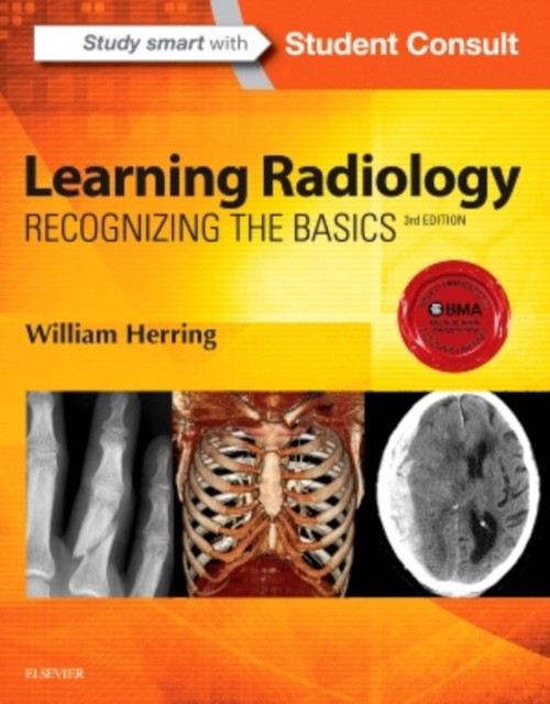 Learning Radiology: Recognizing the Basics, 3rd Edition