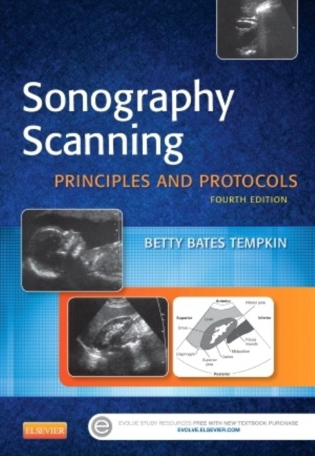 Sonography Scanning,