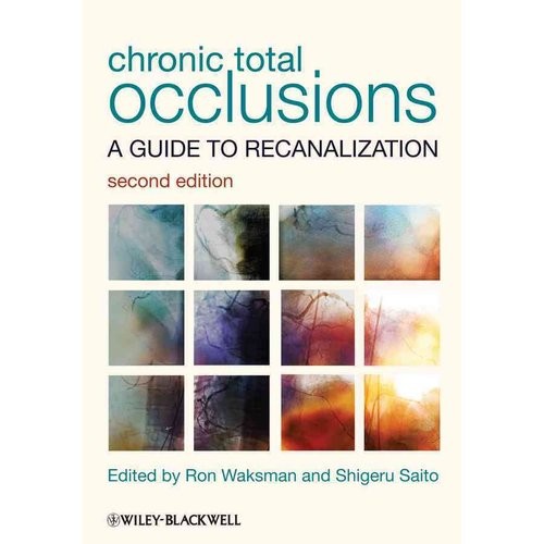 Chronic Total Occlusions: A Guide to Recanalization, 2nd Edition