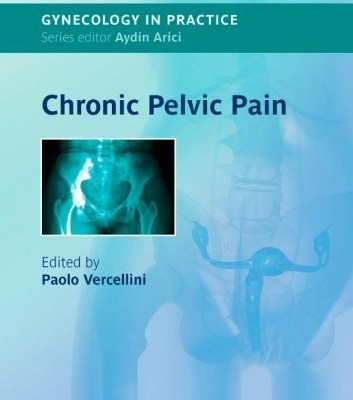 Chronic Pelvic Pain