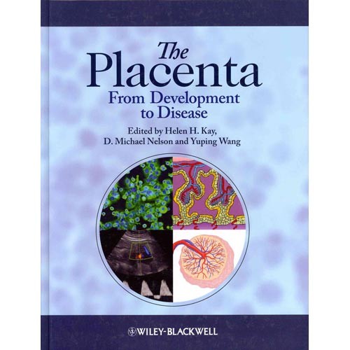 The Placenta: From Development to Disease