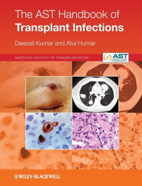 AST Handbook of Transplant Infections