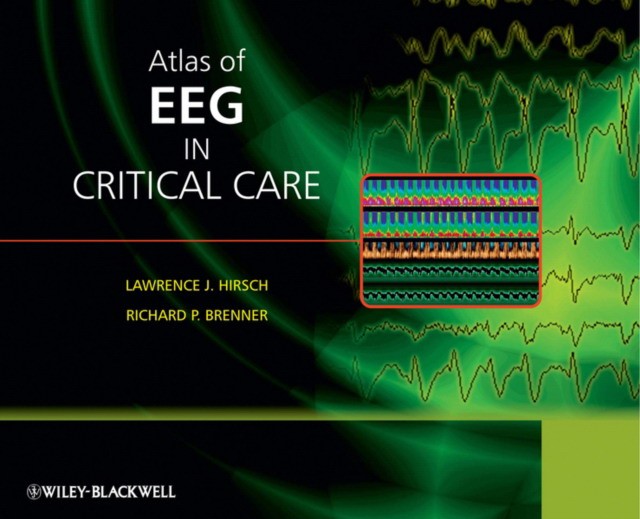 Atlas of eeg in critical care