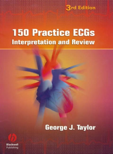 150 Practice ECG’s