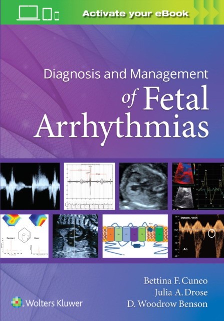 DIAGNOSIS MANAGEMENT FETAL ARRHYTHMIA CB