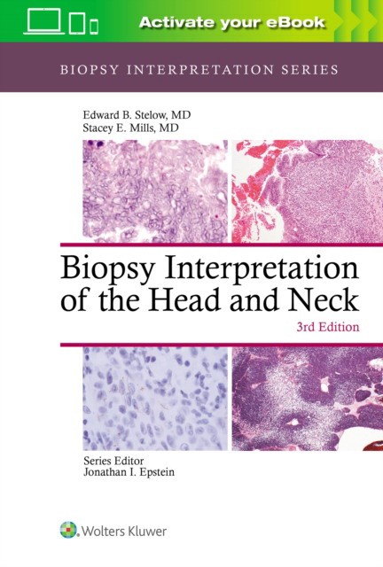 BIOPSY INTERPRETATION HEAD NECK 3E  CB