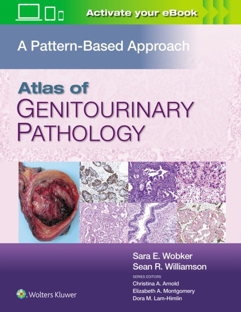 ATLAS OF GENITOURINARY PATHOLOGY CB ATLAS OF GENITOURINARY PATHOLOGY CB