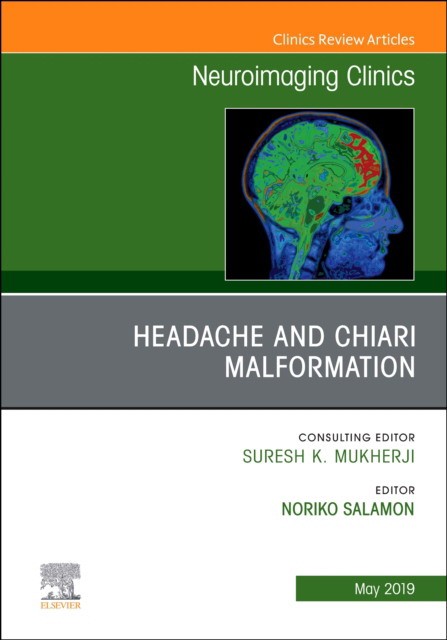 Headache And Chiari Malformation, An Issue Of Neuroimaging Clinics Ofnorth America,29-2