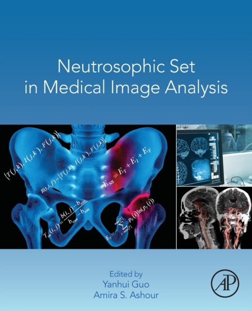 Neutrosophic Set In Medical Image Analysis