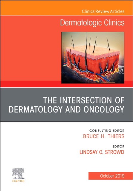 The Intersection Of Dermatology And Oncology, An Issue Of Dermatologic Clinics,37-4