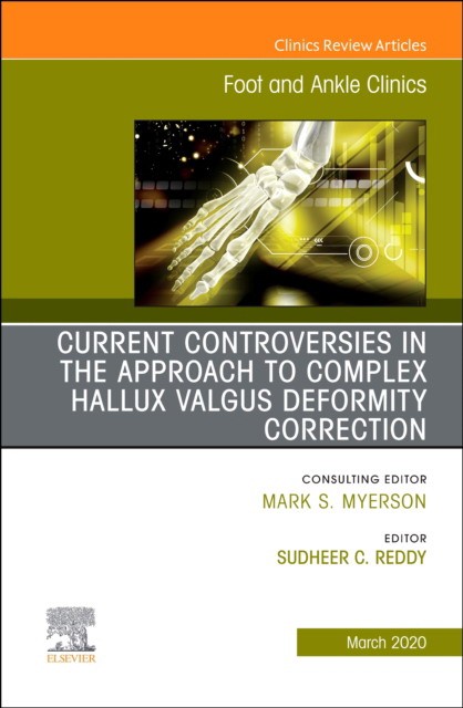 Controversies In The Approach To Complex Hallux Valgus Deformity Correction, An Issue Of Foot And Ankle Clinics Of North America,25-1