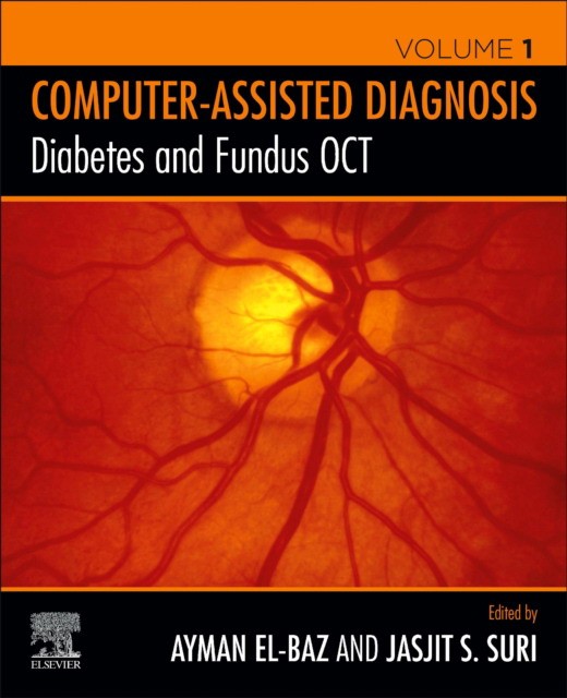 Diabetes And Fundus Oct