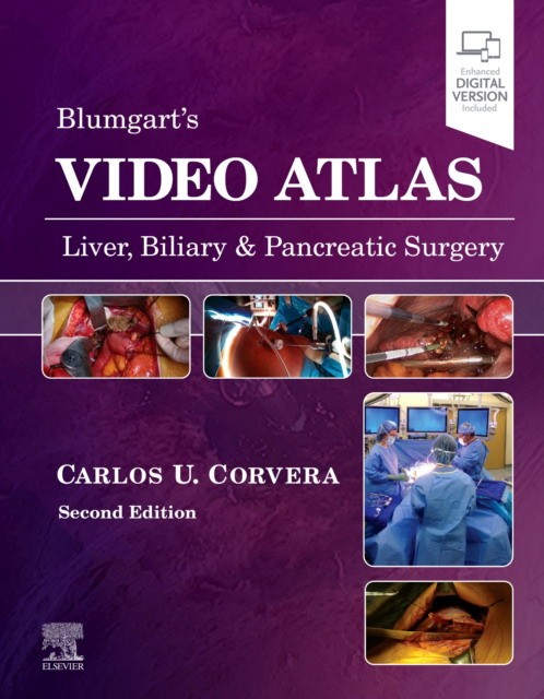 Video Atlas: Liver, Biliary & Pancreatic Surgery