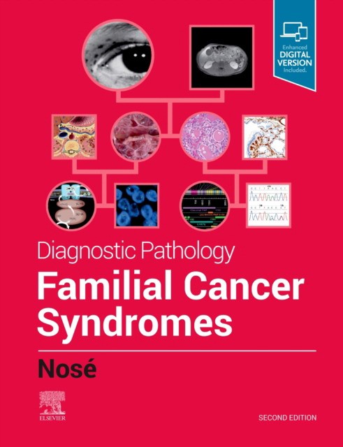 Diagnostic Pathology: Familial Cancer Syndromes