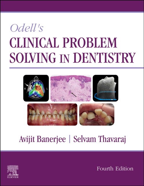 Clinical Problem Solving In Dentistry