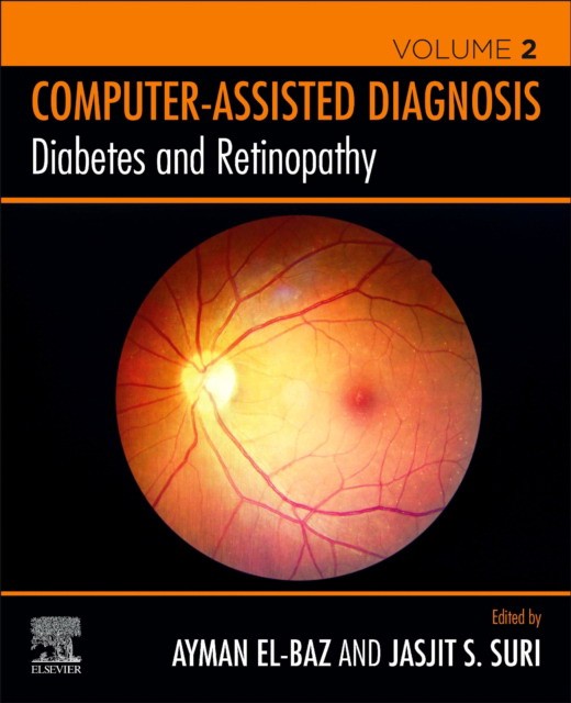 Diabetes And Retinopathy