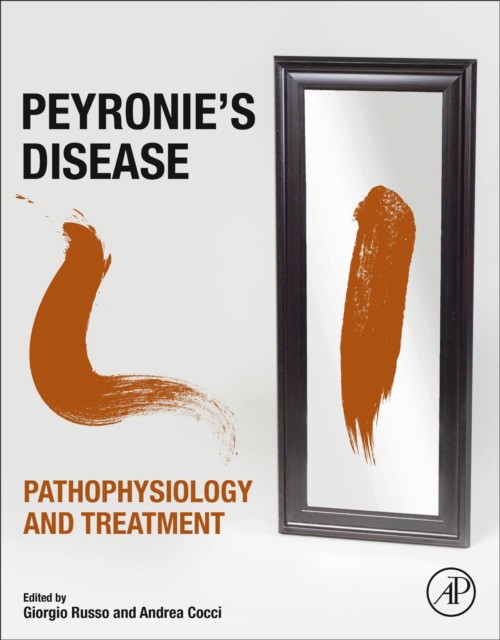 Peyronie'S Disease: Pathophysiology And Treatment