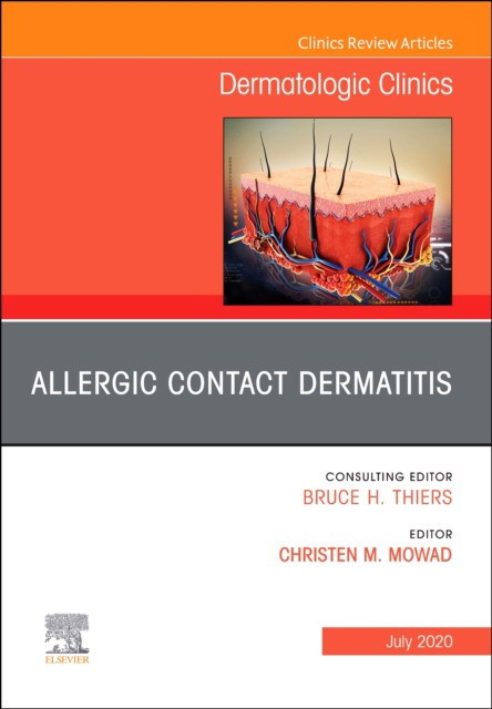 Allergic Contact Dermatitis,An Issue Of Dermatologic Clinics,38-3