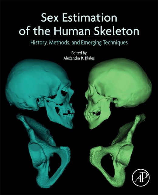 Sex Estimation Of The Human Skeleton