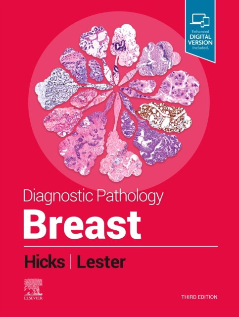 Diagnostic Pathology: Breast. 3 ed