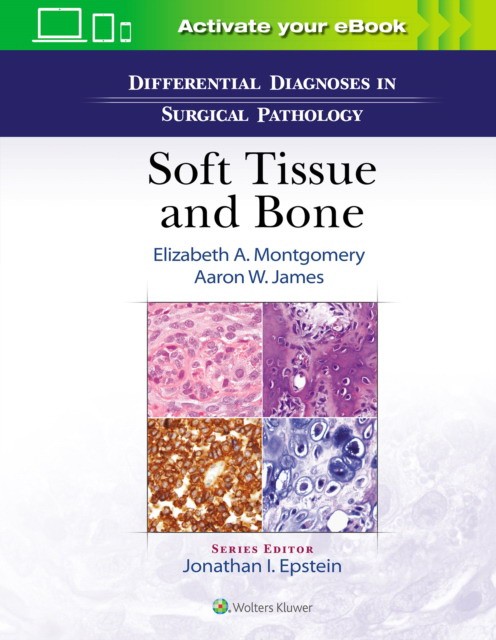 Differential Diagnoses in Surgical Pathology: Soft Tissue and Bone