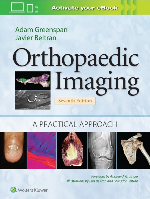 Orthopaedic Imaging: A Practical Approach